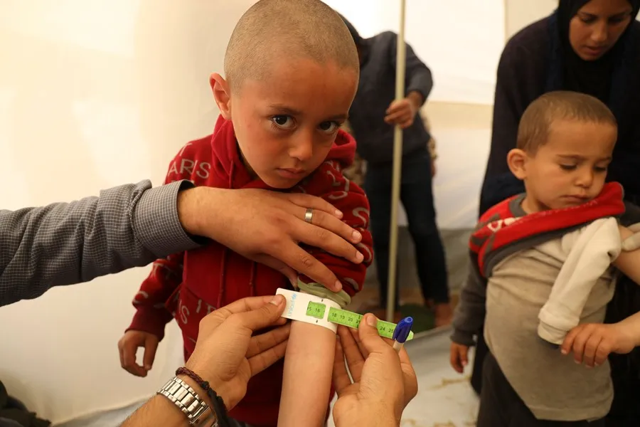 A Mohammad, de 3 años, le miden la circunferencia media del brazo como parte de su examen de desnutrición en una tienda de campaña apoyada por UNICEF en la ciudad de Rafah, al sur de la Franja de Gaza. EFE/ Eyad El Baba/UNICEF