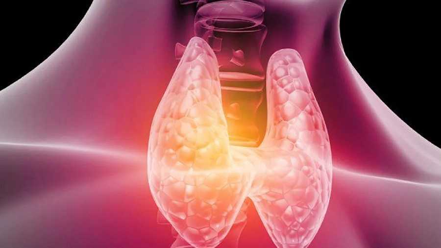 Tiroides enferma? - Dr Carlos Jaramillo