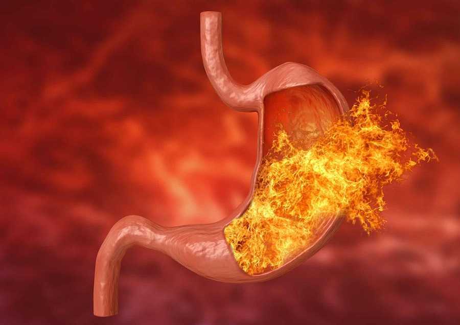 Cura tu gastritis ¡Con estos pasos!