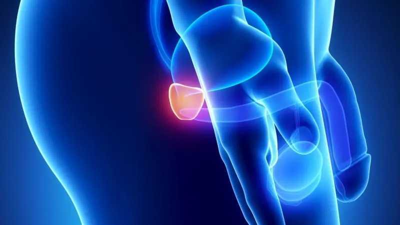Cáncer de próstata