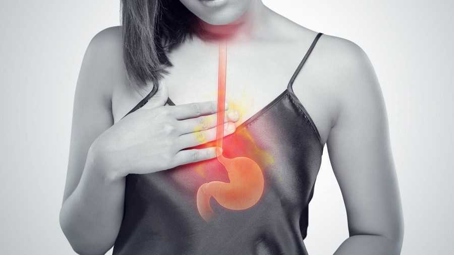 Reflujo silencioso: miles en riesgo