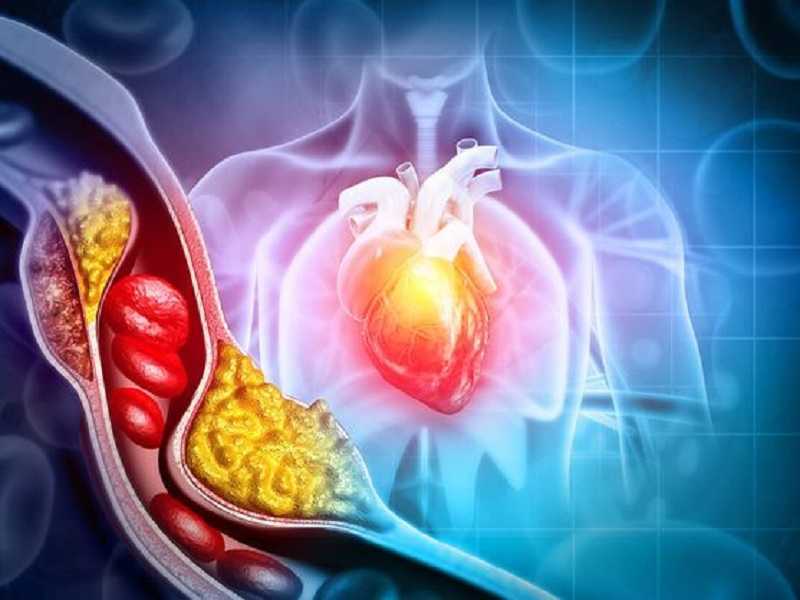 Colesterol ¿Bueno y malo? | Descubre toda la verdad