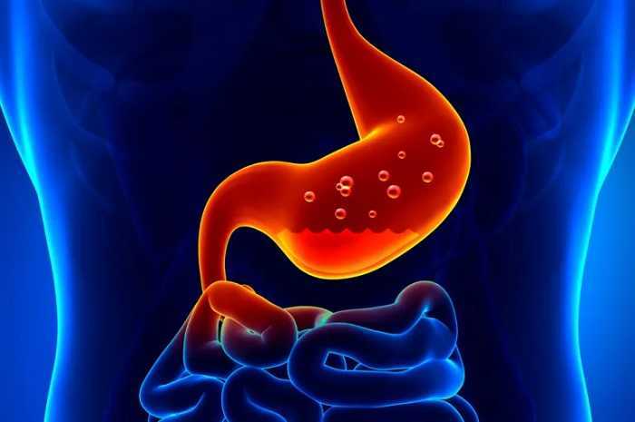 Gastritis o reflujo