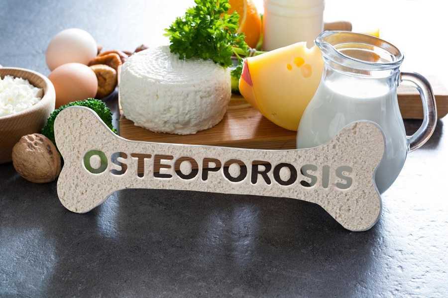Fortalece tus huesos con estos 5 pasos