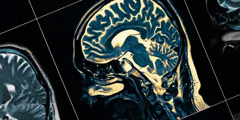 Qué le ocurre al cerebro cuando morimos