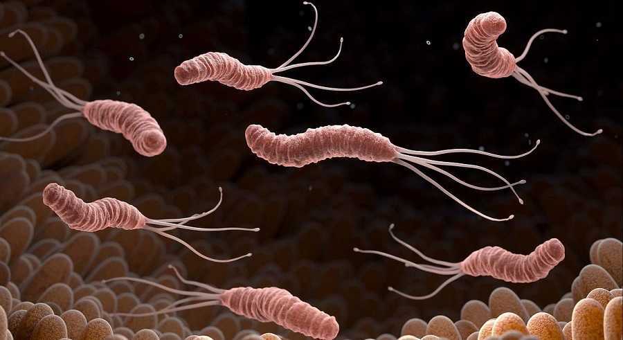 Tratamiento efectivo contra el Helicobacter Pylori | Paso a paso