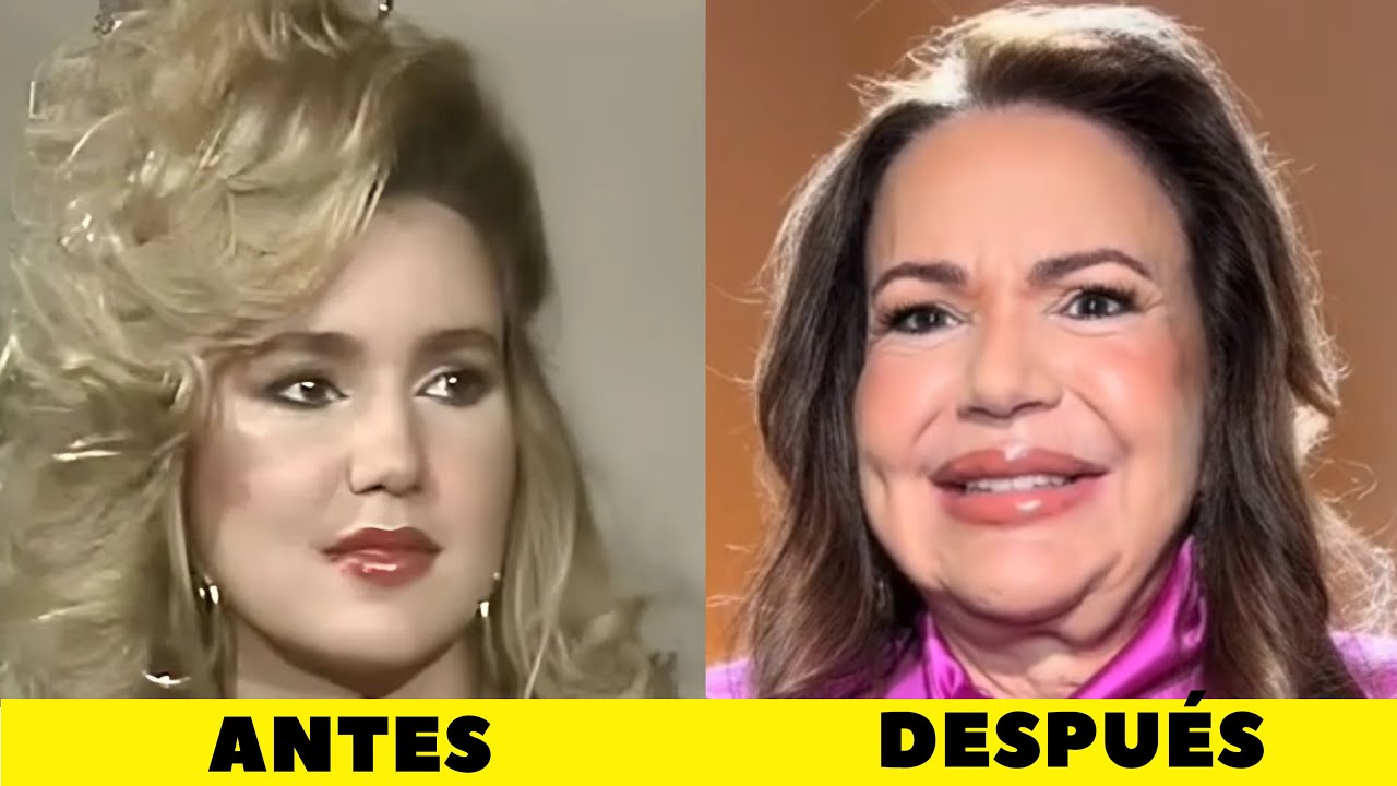 Actrices venezolanas antes y después