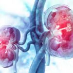 ¡Problemas renales! Signos ocultos que podrías tener y no saberlo
