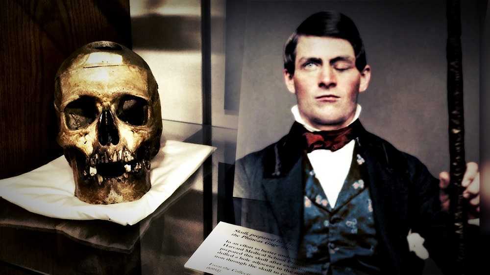 Phineas Gage y su inexplicable caso
