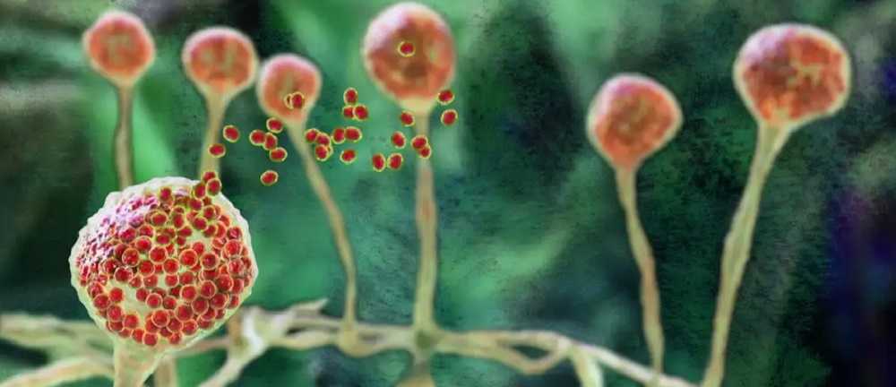 Infecciones fúngicas invasivas