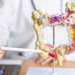 Gastritis-gases-colon irritable