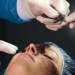 El lado oscuro del boom de las cirugías estéticas en China