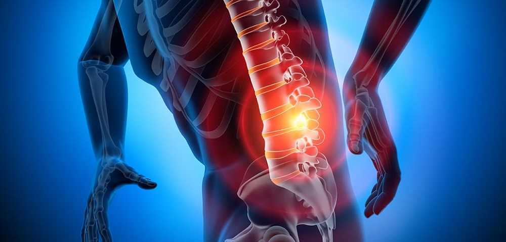 Tu espalda cuando tienes una hernia