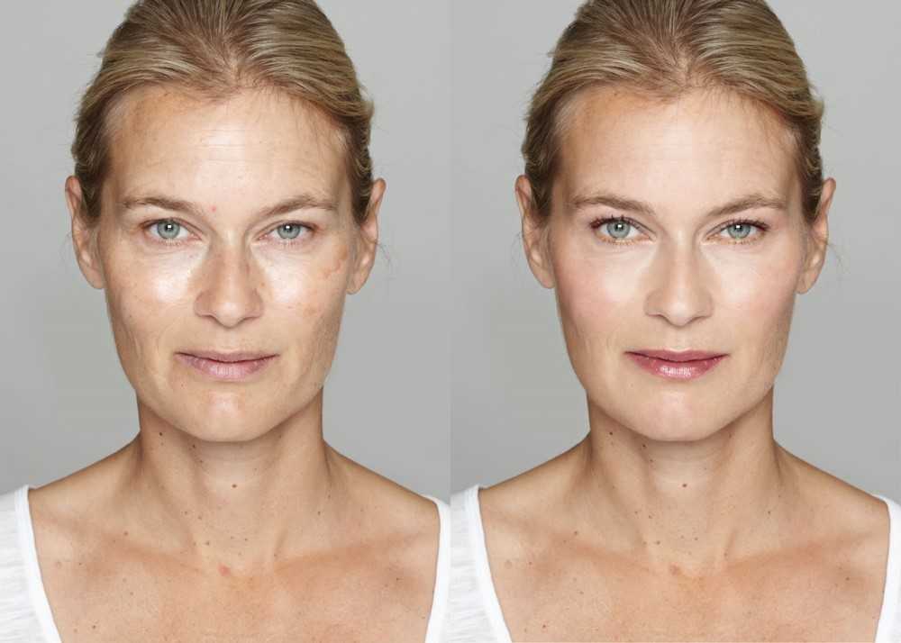 Puedes rejuvenecer activando tus células madre