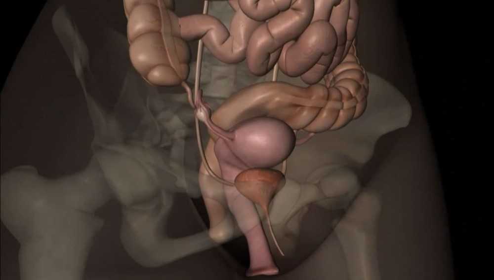 La endometriosis