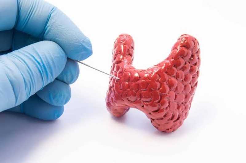 Nutrientes para la tiroides