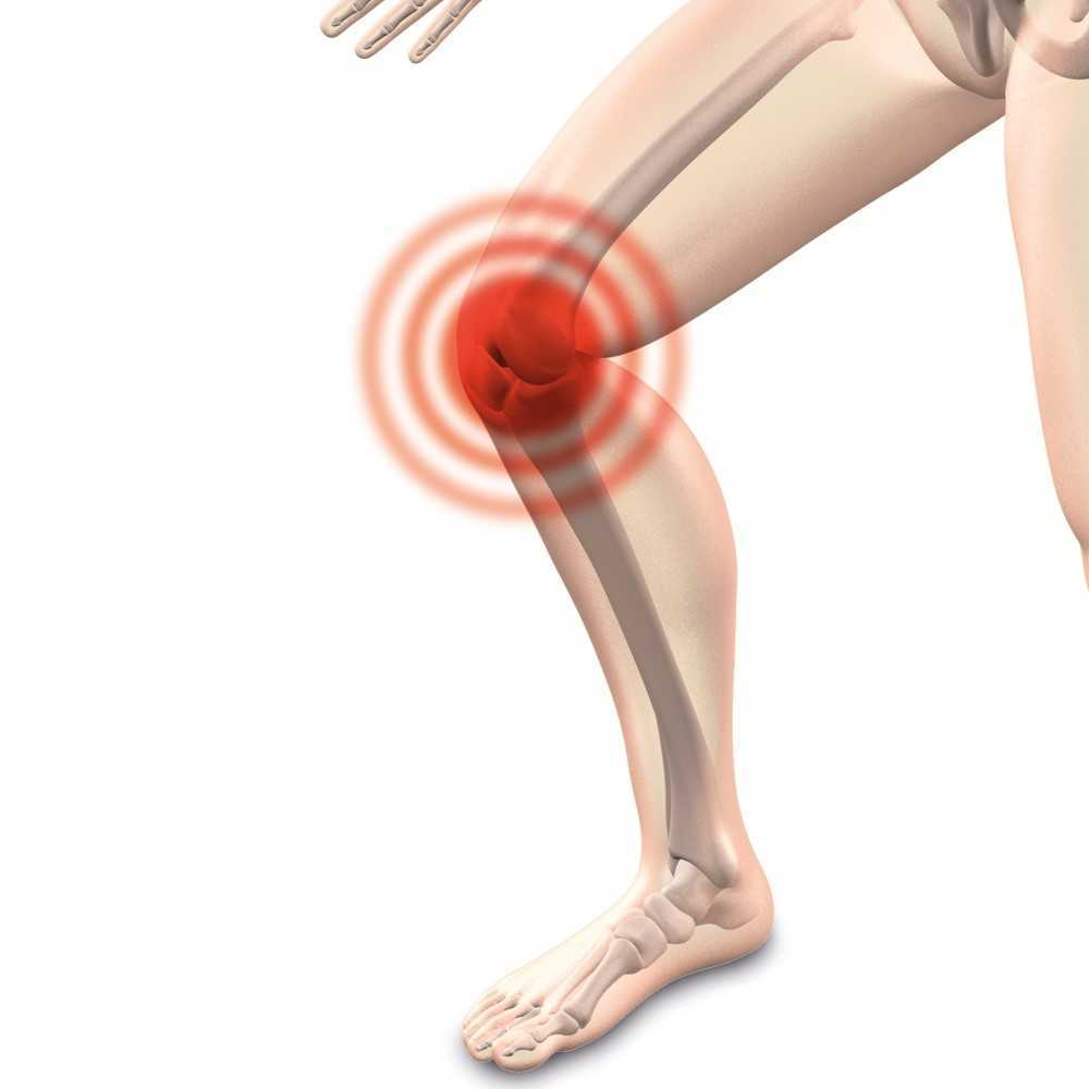 ¿Dónde te duele la rodilla?